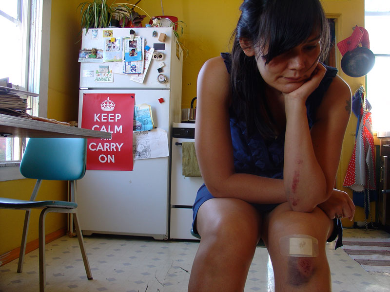 bruise_mrg